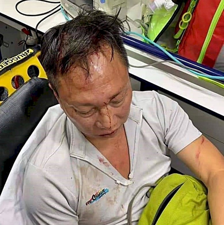 Another HK police officer attacked