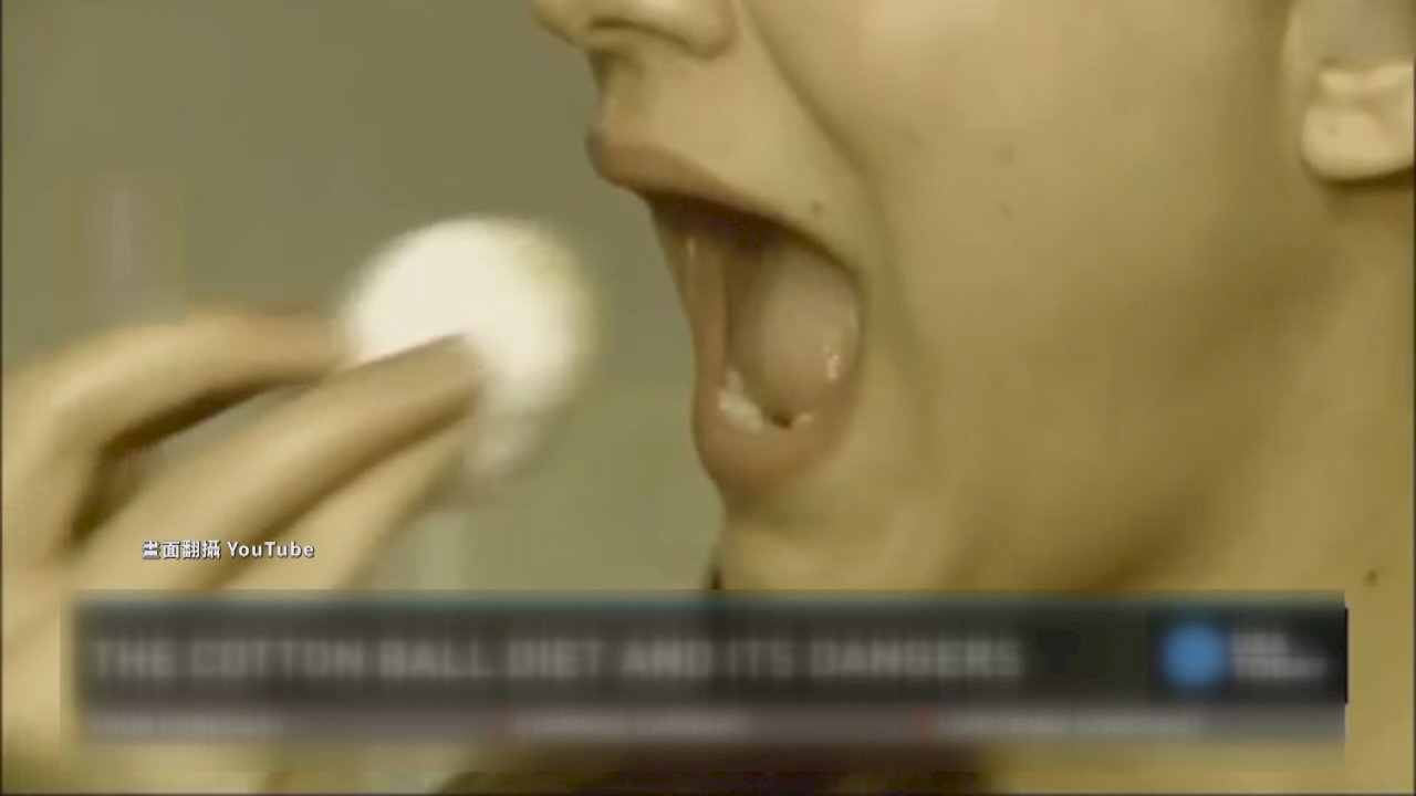 Video: “Cotton ball diet” sends Taiwan woman to the hospital