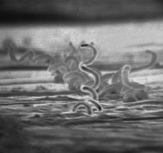 Syphilis surge in Tokyo could see record high cases three years in a row